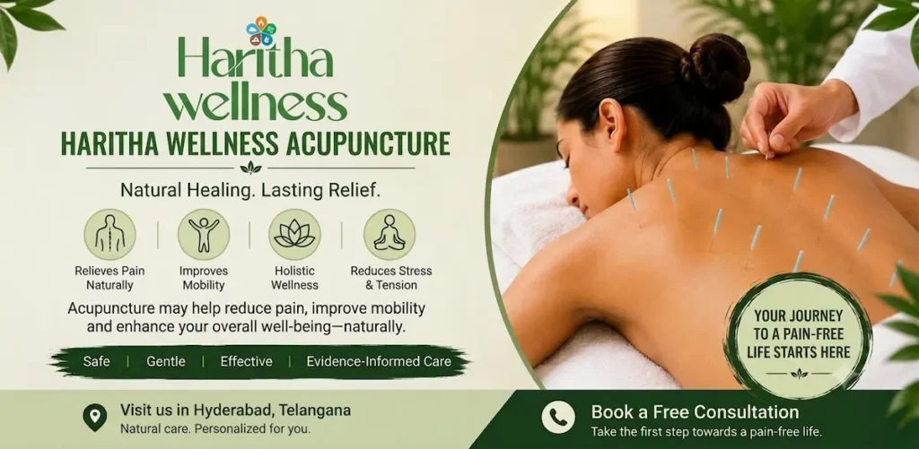 Acupuncture for pain relief treatment with fine needles for back pain and muscle tension